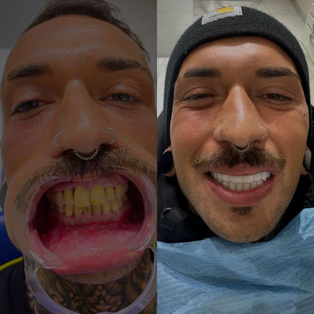 Prima e dopo Eurovita 3